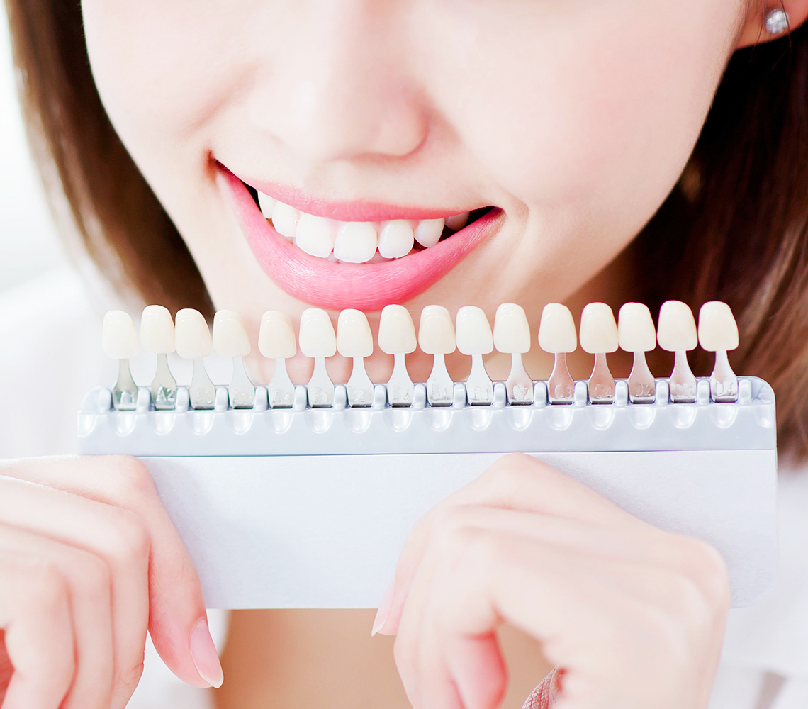 ホワイトニング